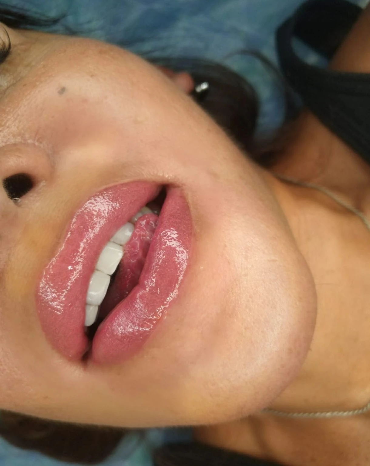 Micro Labial