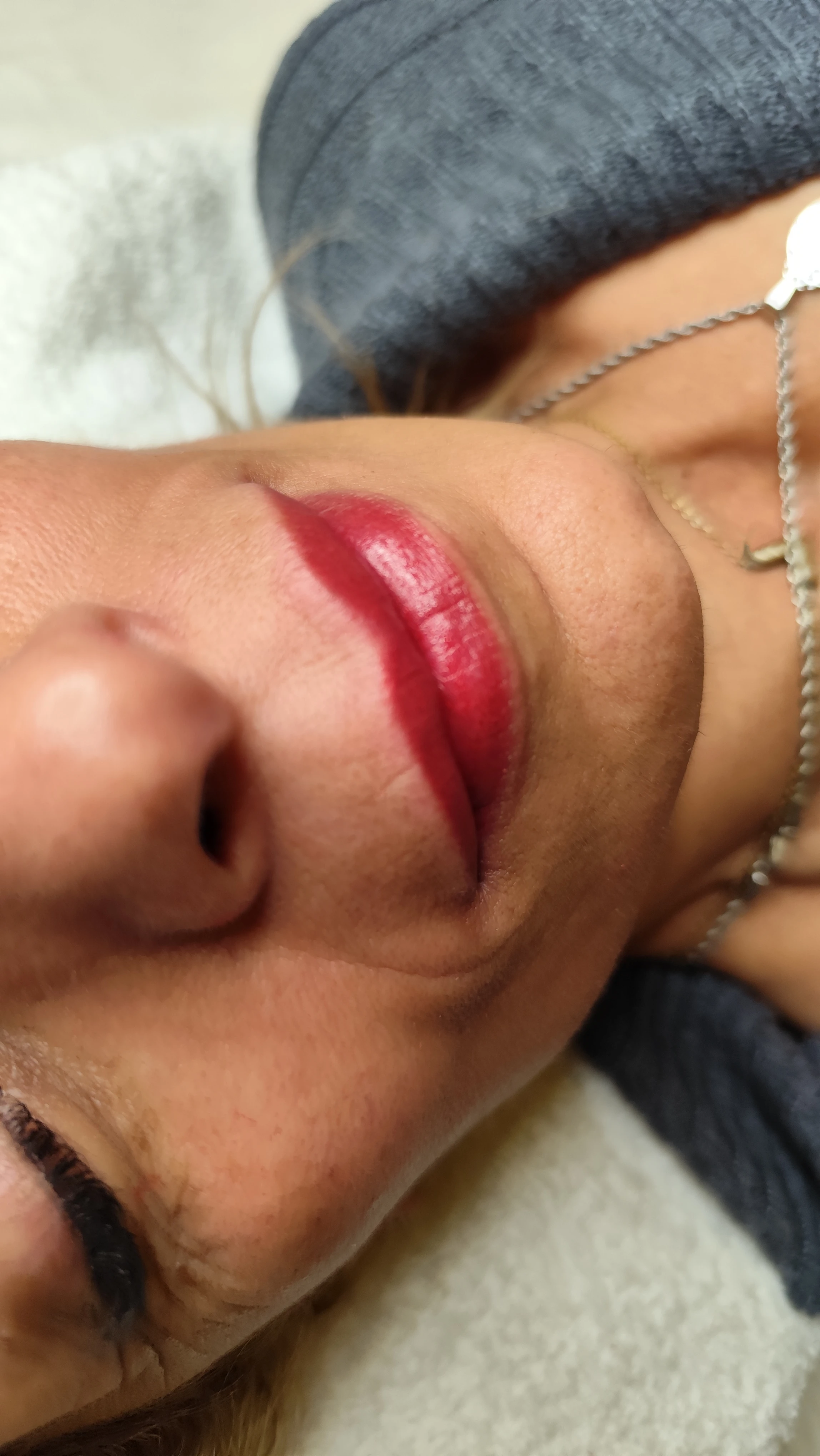 Micro Labial Retoque